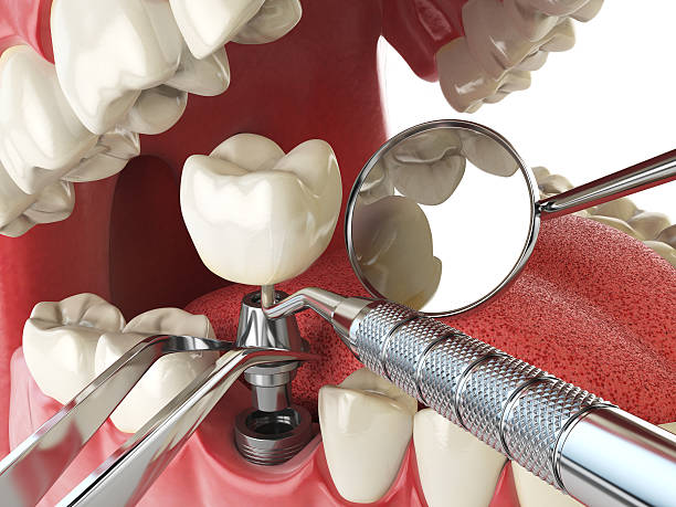 Best Weekend Emergency Dentist in Wakarusa, IN